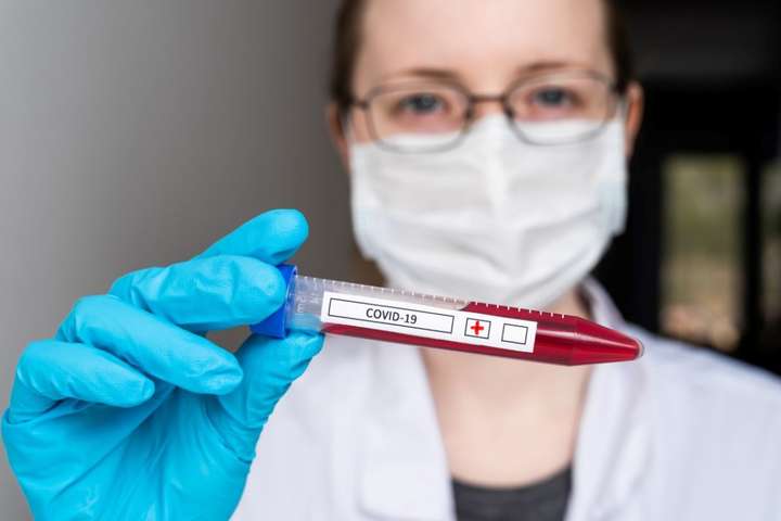 Під час дослідження фахівці ввели альпаці S-білок коронавіруса, через 60 днів в зразках крові тварин спостерігалася сильна імунна відповідь - Вчені знайшли засіб, що захищає від коронавірусу