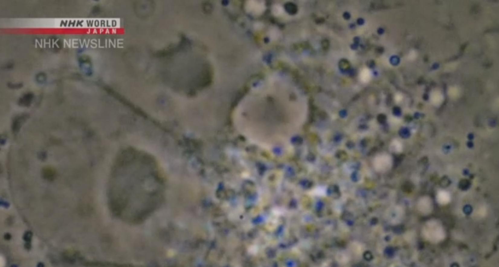 Вчені показали, як COVID-19 вбиває клітини в організмі. Фото