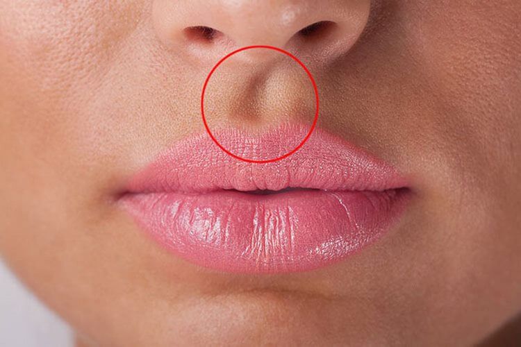 Маленька канавка, яка відокремлює губи від носа, називається губний жолобок. Він утворюється в ході розвитку на другому-третьому місяці вагітності
